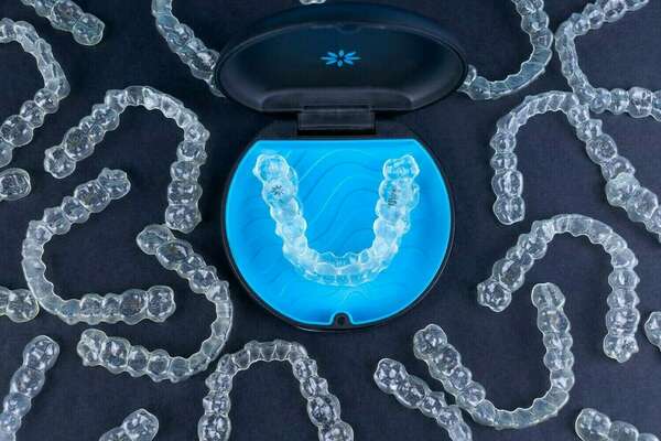 La technique invisalign® – align technology