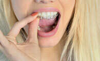 Orthodontie Invisible : le traitement par gouttières