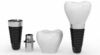 Implant dentaire
