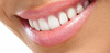 Sourire