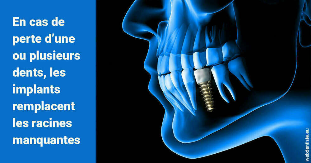 Les implants
