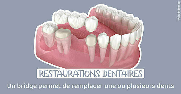 Bridge remplacer dents