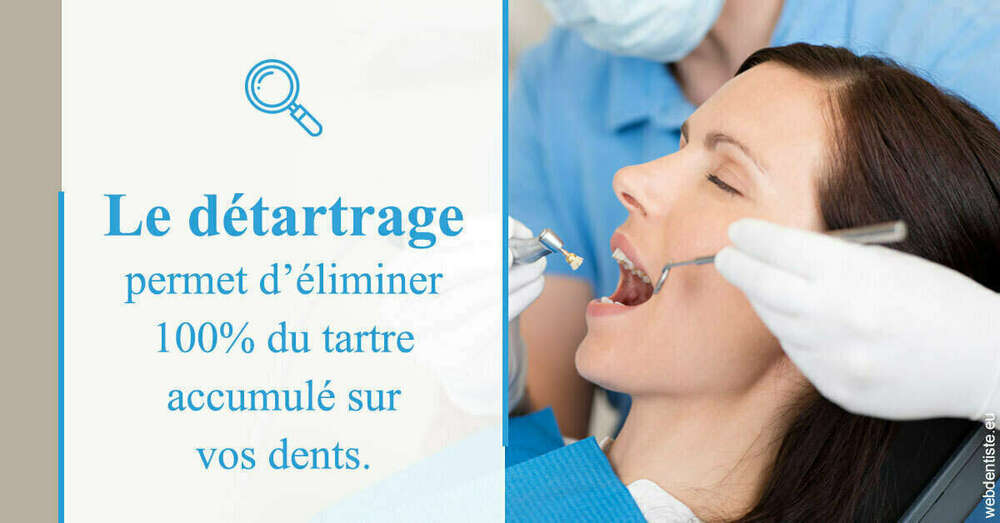 En quoi consiste le détartrage