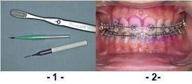 INSTRUCTIONS DE BROSSAGE DENTAIRE AVEC UN APPAREIL ORTHODONTIQUE FIXE