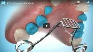 Grille anti pouce ou anti langue