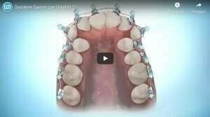 Système Damon par Dolphin 2