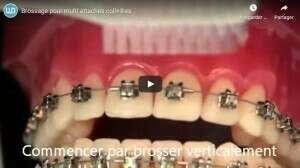 Brossage pour multi attaches collées