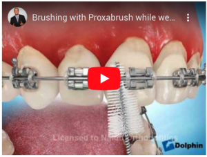 Brossage avec brossette