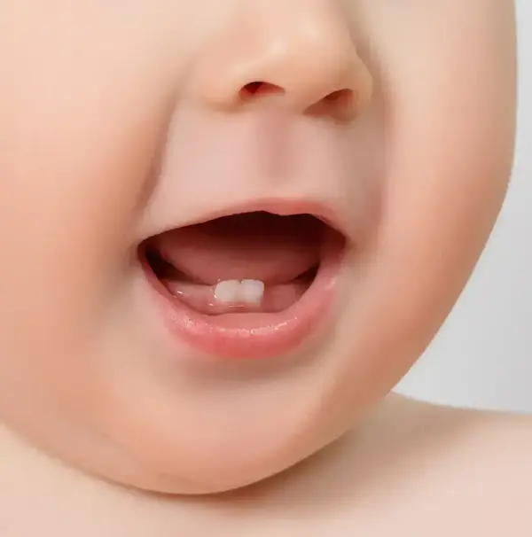 L’éruption des dents de lait et des dents définitives