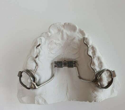 L'orthodontie enfant/ado