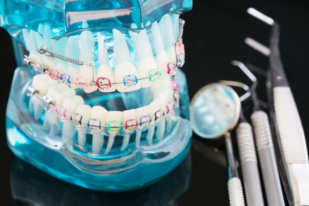 INCIDENTS ET URGENCES ORTHODONTIQUES
