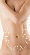 soins minceur Limoges