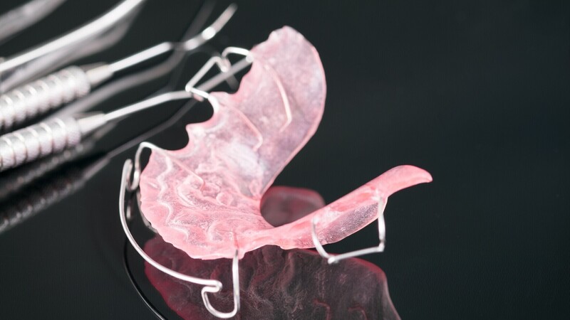 plaques orthodontiques enfant, cabinet du Boutonnet