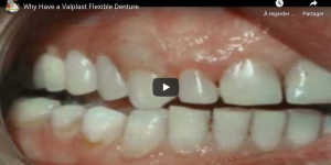 VALPLAST® - TCS Flexible®