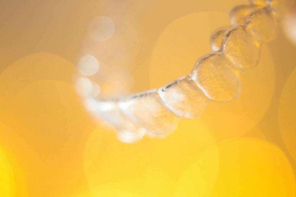 L'ORTHODONTIE INVISIBLE