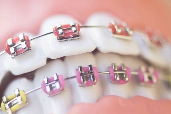 LE DOSSIER ORTHODONTIQUE