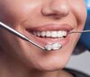 	Examen d'un sourire avec un miroir dentaire
