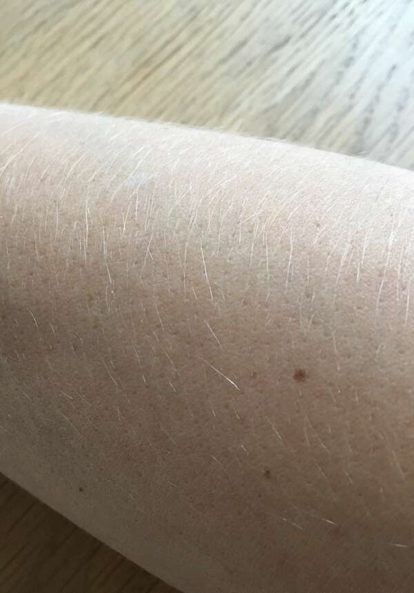 Eczéma, je m'en nettoie