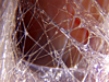 Fascia, une toile d'araignée humide
