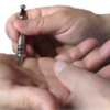 Manupuncture Acupuncture sans aiguille