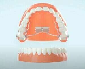 Activation disjoncteur