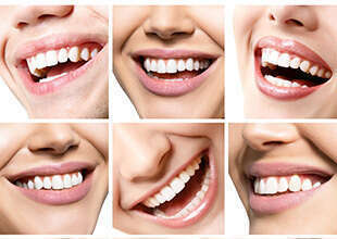 LA LIGNE DU SOURIRE - DR OHANA - DENTISTE À COURBEVOIE 92400