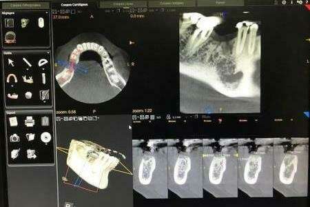 9mpd2qfgzc_1610095664