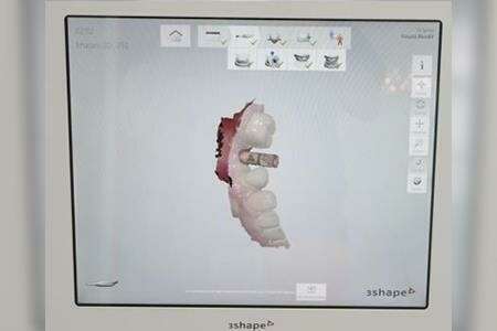 u4hotvnraa_1610095714