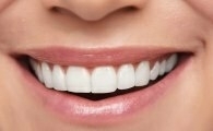 L'esthétique du sourire