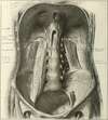 Illustration du muscle ilio-psoas entre colonne et hanche