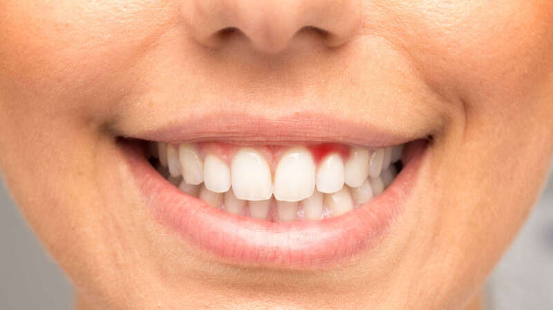 Parodontologie à Soustons