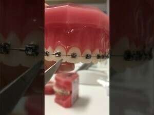 COMMENT RETIRER UN ARC