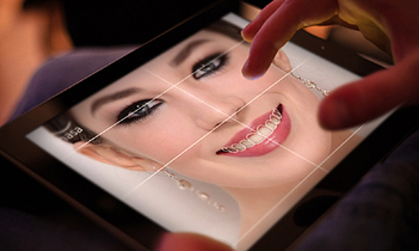 La 3D au service de votre sourire
