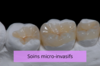 Soins micro-invasifs