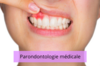 Parodontologie médicale