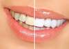 Dr laure vaucher dentiste au chesnay