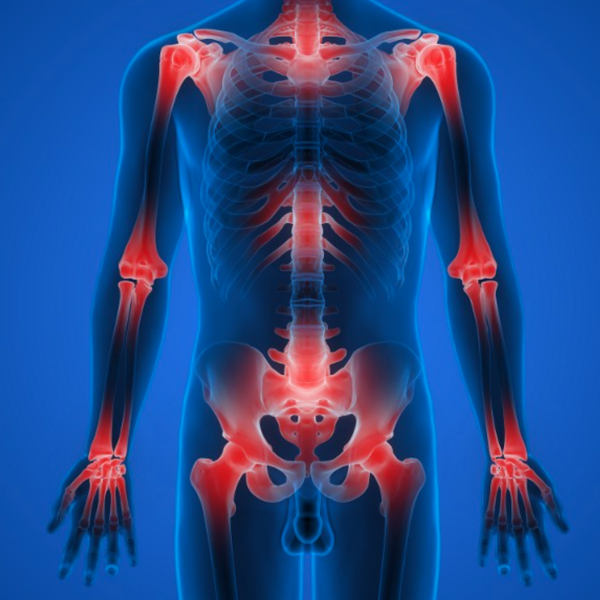 Stratégies alimentaires pour réduire les inflammations articulaires