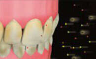 LES COLORATIONS DENTAIRES