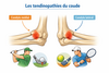 schéma tendinopathie du coude