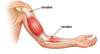 schéma des tendons