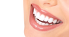Sourire bouche