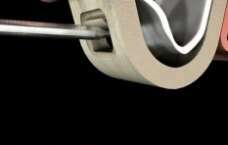 GREFFE OSSEUSE ET SINUS LIFT