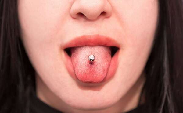 Les dangers du piercing buccal