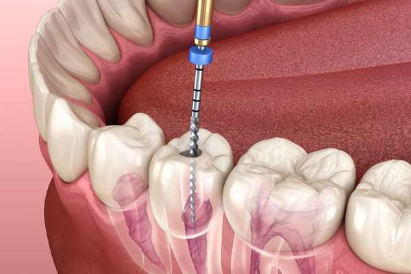 Endodontie