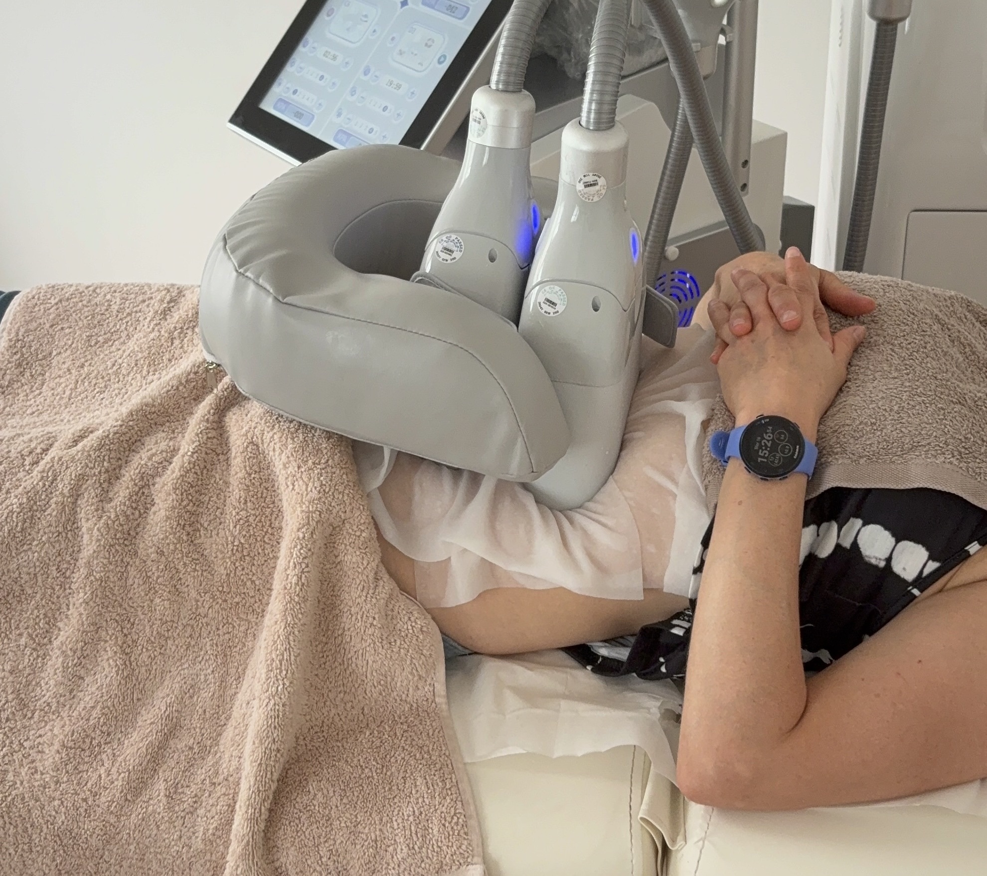 Thème : amincissement naturel par cryolipolyse