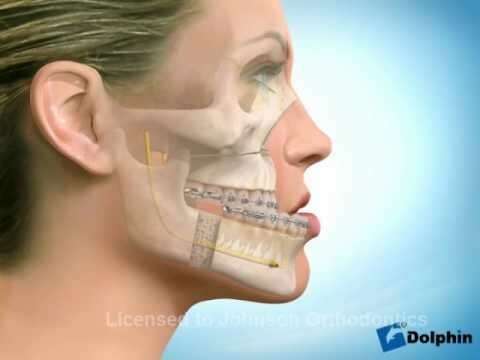 Comment fait le chirurgien ?