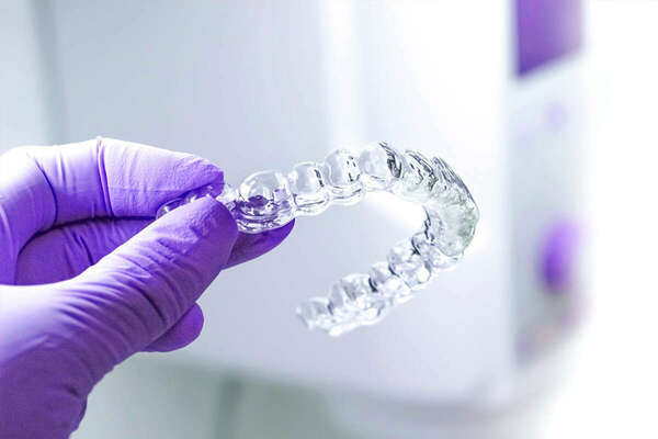 Les traitements par aligneurs transparents en 10 questions