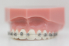 Appareil dentaire Cabinet d'Orthodontie des Drs BOURHIS et LAWNICZAK