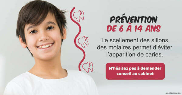 T2 2024 - scellement des sillons