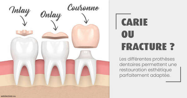 T2 2024 - carie ou fracture